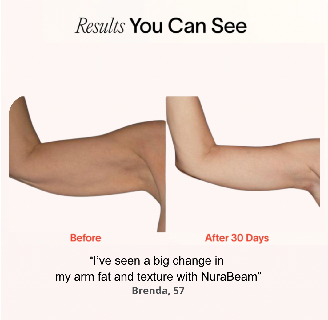 Arm Bands