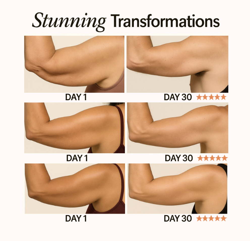 NuraSculpt™ Arm Bands.