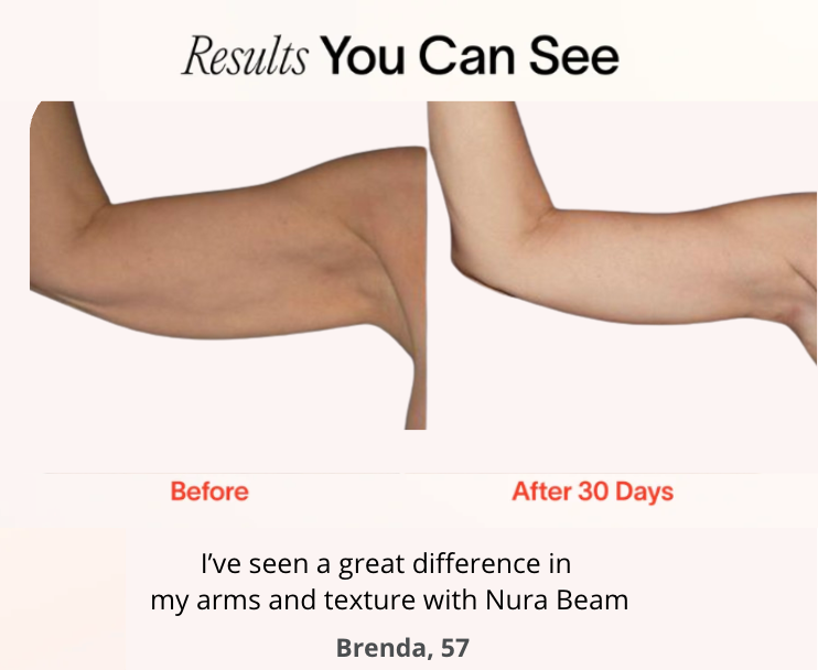 NuraSculpt™ Arm Bands.