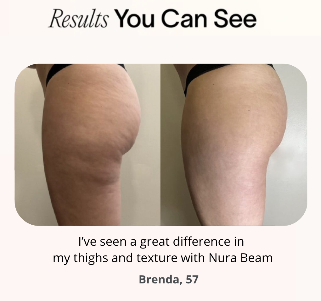 NuraSculpt™ Calves Wrap