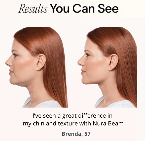 NuraSculpt™ Double Chin Wrap